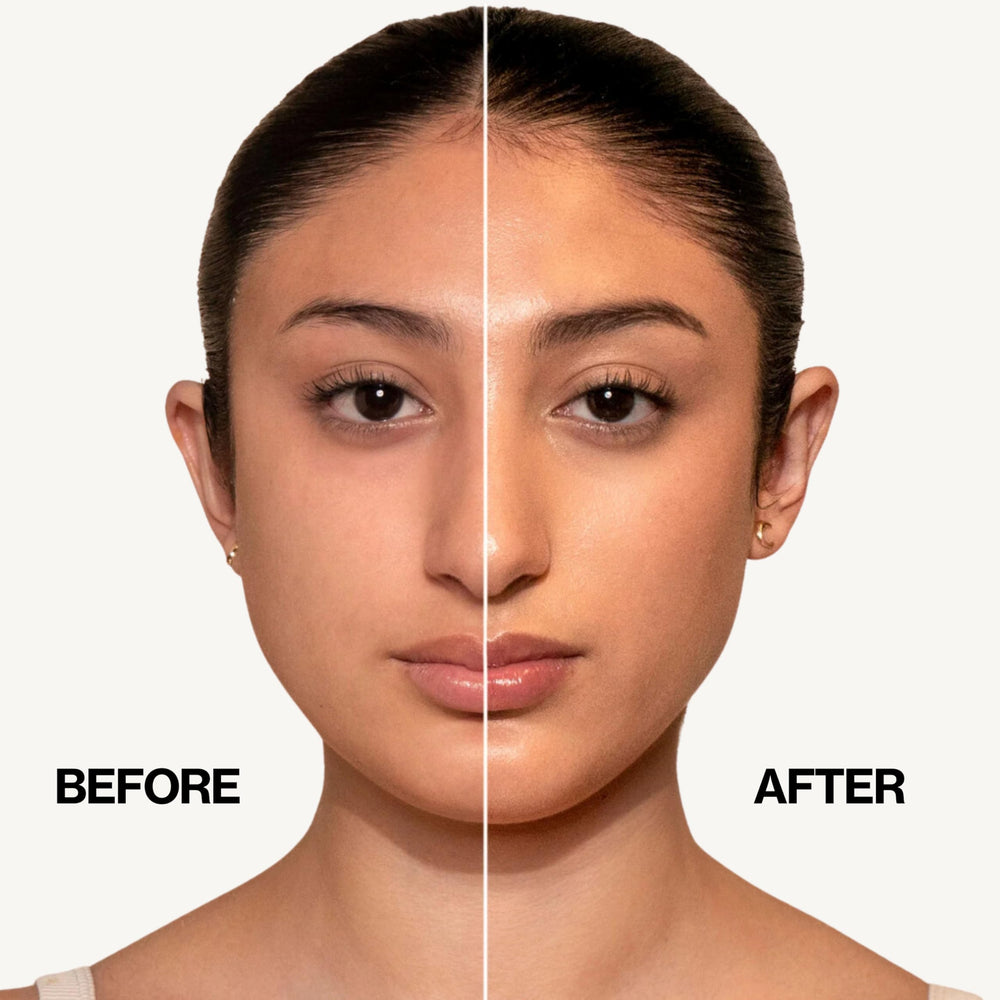 Exfoliante apto para piel propensa al acné.