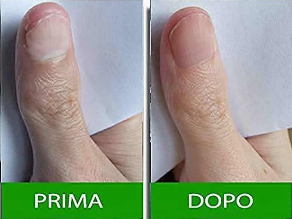 Pantogar : gelule en détail, amélioration potentielle de la routine capillaire.