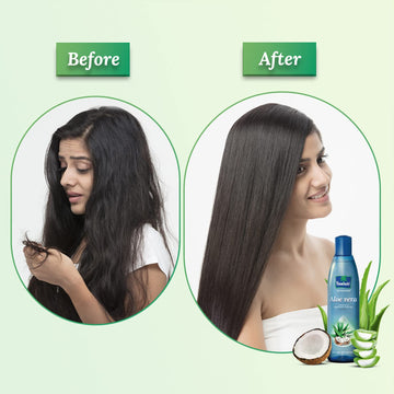Parachute Advansed Aloe Vera Enriquecido Aceite Coco Cabello Uso Diario para cuidado constante.