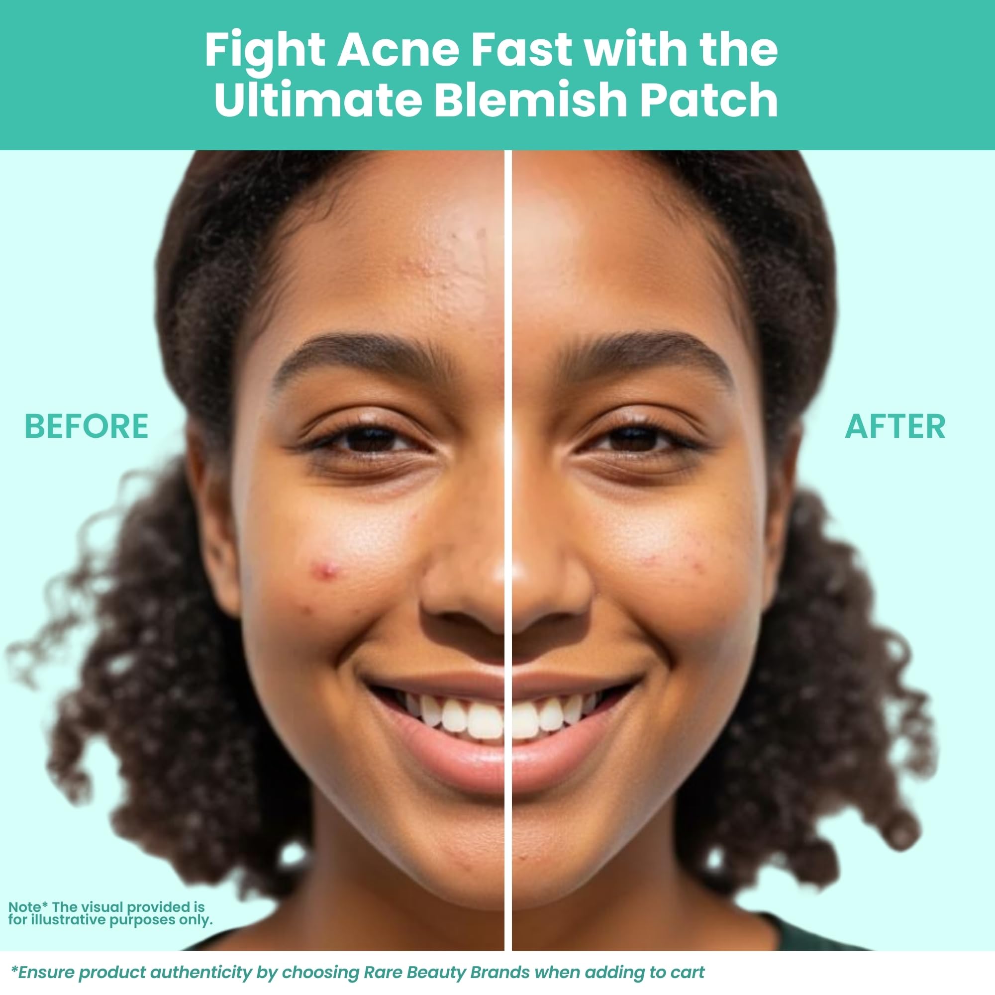 Patchology Breakout Box aceite de árbol de té y hamamelis para cuidado suave