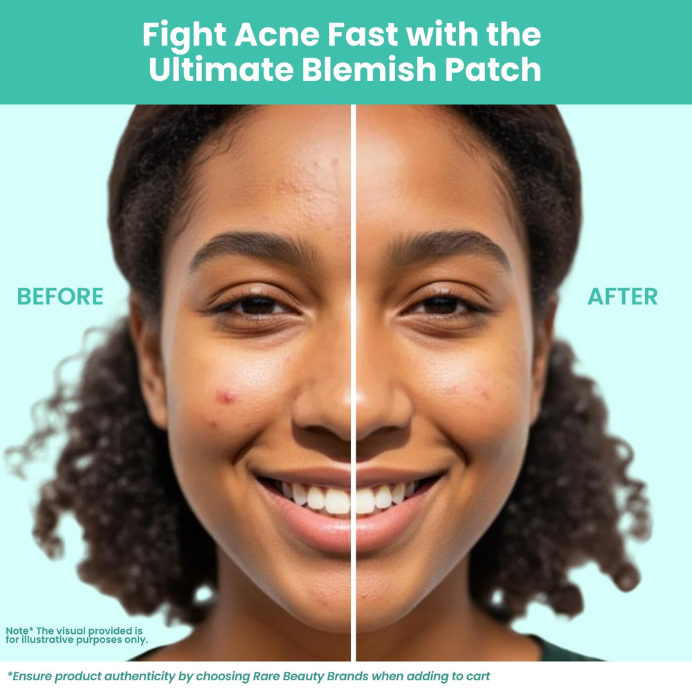 Patchology Breakout Box aceite de árbol de té y hamamelis para cuidado suave