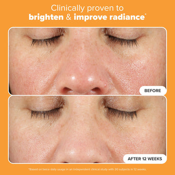 Ferúlico en Paula's Choice Boost C15 Serum defiende contra daño ambiental.