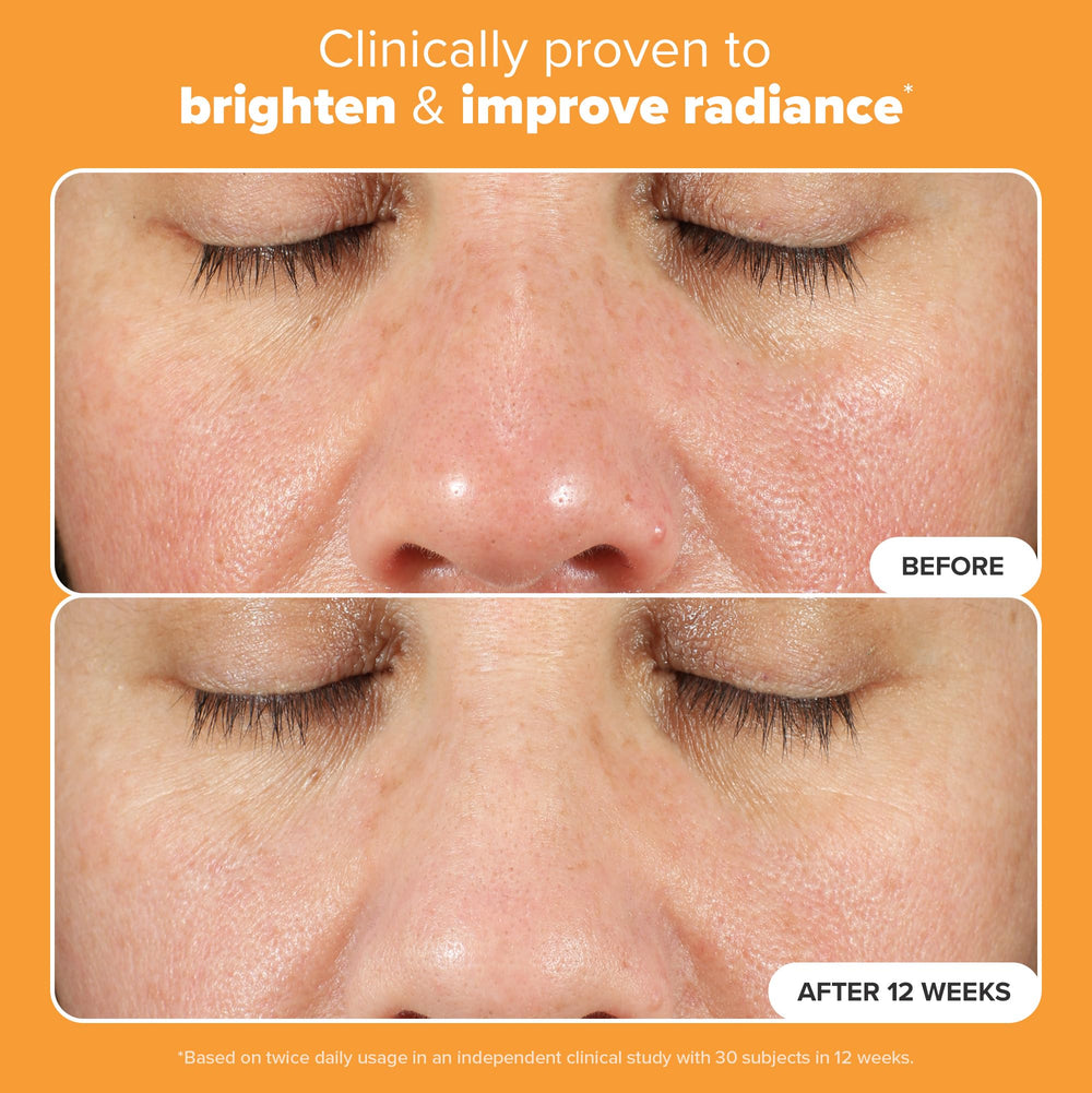 Ferúlico en Paula's Choice Boost C15 Serum defiende contra daño ambiental.