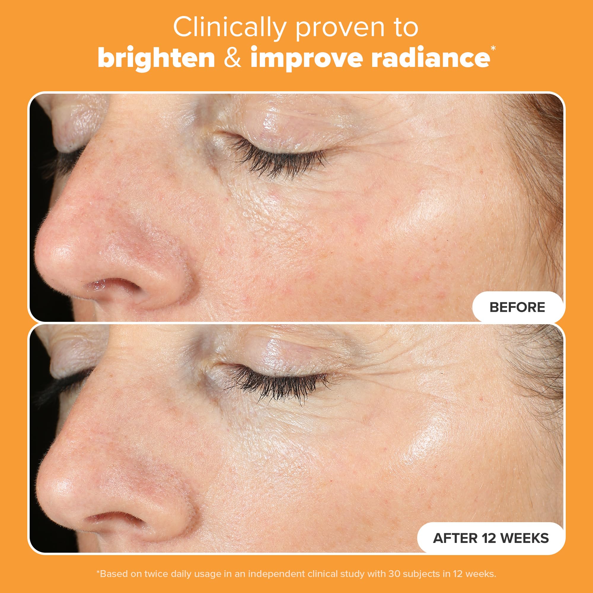 Vitamina C al 15% en Paula's Choice Boost C15 Serum para tono uniforme.