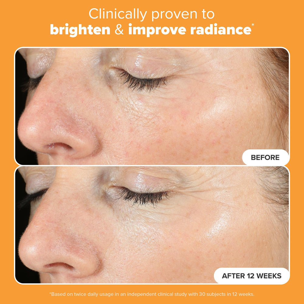 Vitamina C al 15% en Paula's Choice Boost C15 Serum para tono uniforme.