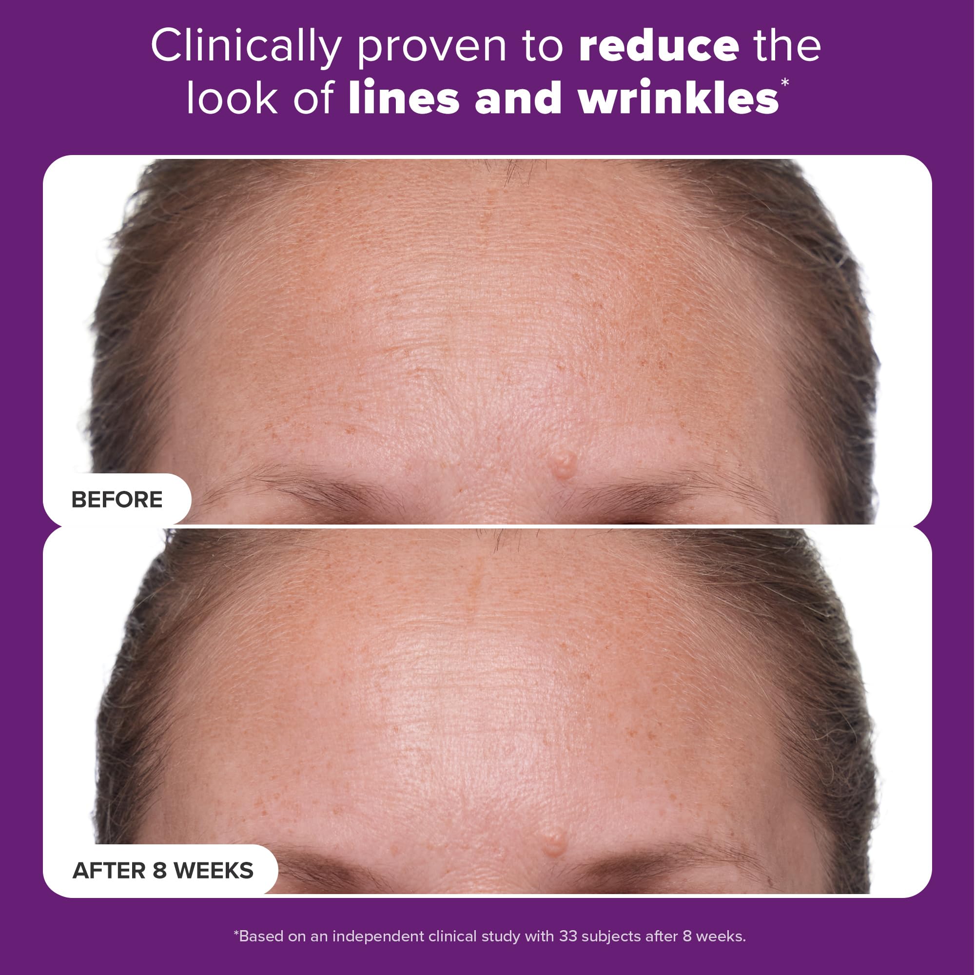 Paula's Choice Clinical 1% Retinol, aplicación nocturna: ideal para rutinas nocturnas