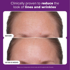 Paula's Choice Clinical 1% Retinol, aplicación nocturna: ideal para rutinas nocturnas
