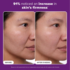 Paula's Choice Clinical 1% Retinol, Vitamina C: tono más uniforme