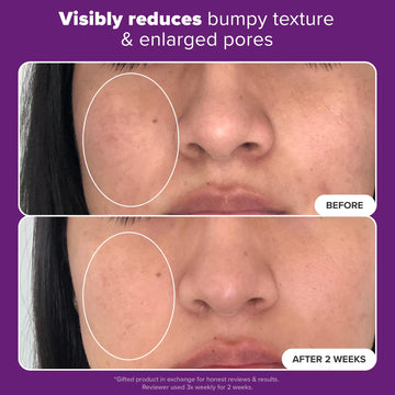 Paula's Choice Clinical 20% Niacinamida: aplicación manual para piel suave y luminosa.