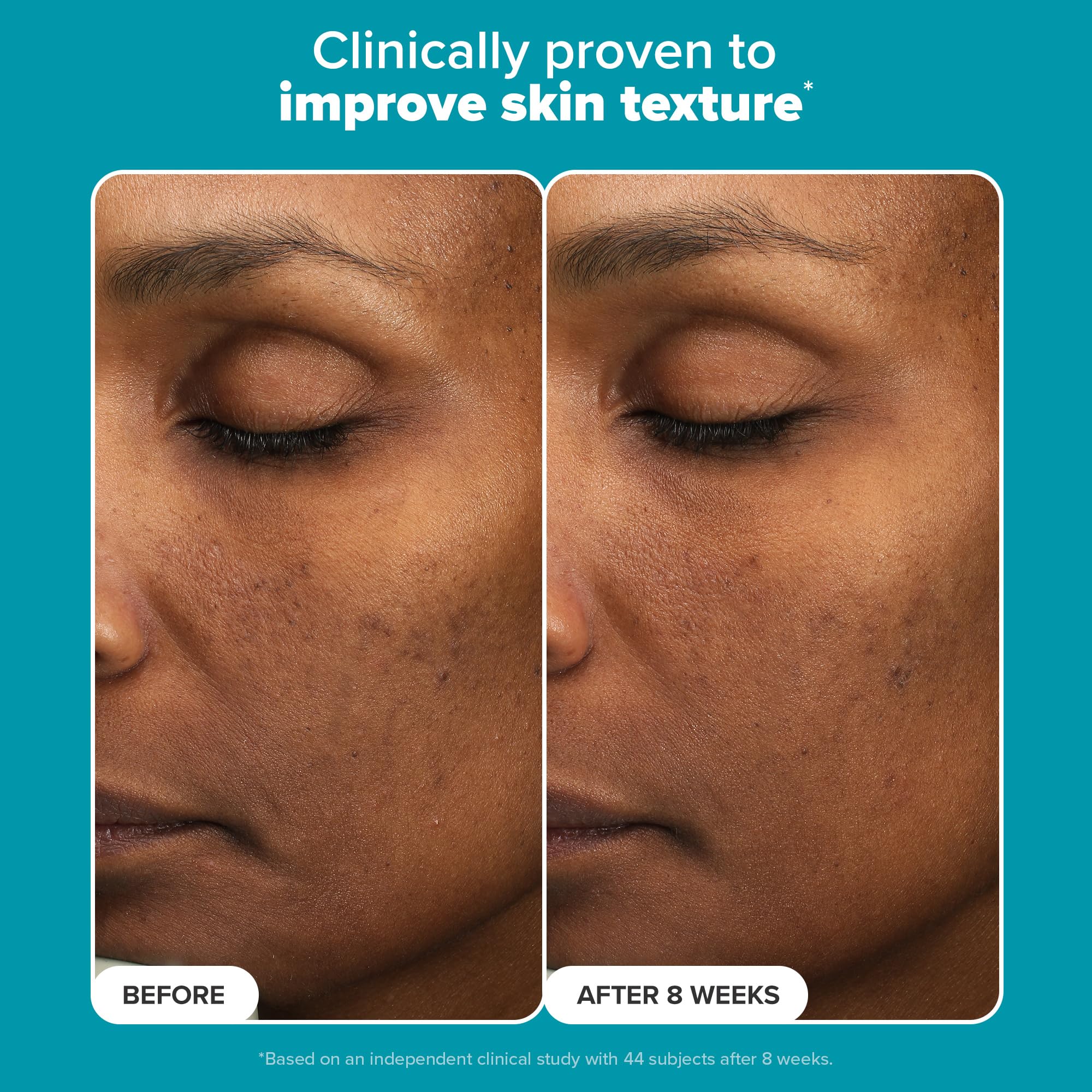 Brillo radiante en la piel con Paula's Choice Exfoliante líquido.
