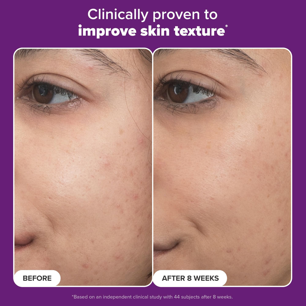 Aplicación en mano con Paula's Choice Pro Retinaldehyde, rutina diaria.