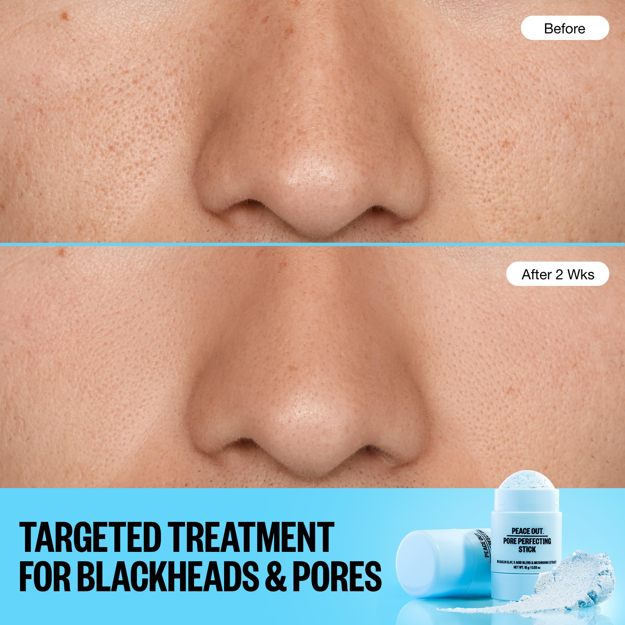 PEACE OUT Stick Exfoliación doble: exfoliante suave y ácidos para renovación.