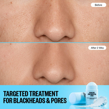 PEACE OUT Stick Exfoliación doble: exfoliante suave y ácidos para renovación.