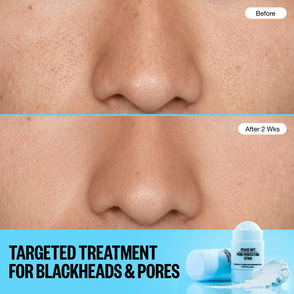 PEACE OUT Stick Exfoliación doble: exfoliante suave y ácidos para renovación.