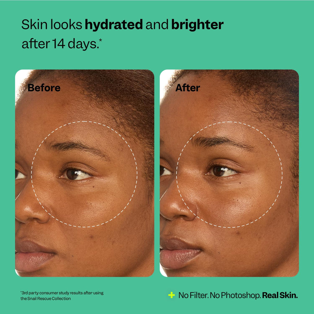 Peach Slices: combinación de mucina y esqualano para hidratación suave.