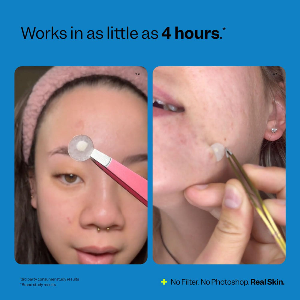 Aplicación Peach Slices en rostro, limpieza suave de la zona.