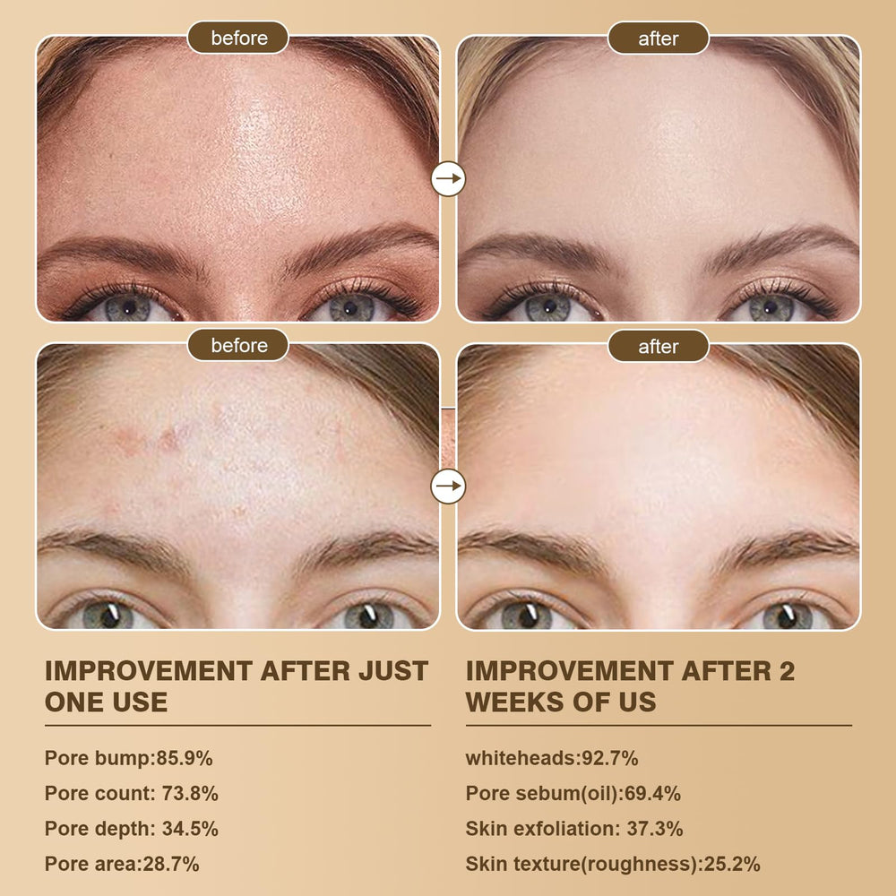 Peel Shot Glow duo pack front view showing day and night exfoliation routine