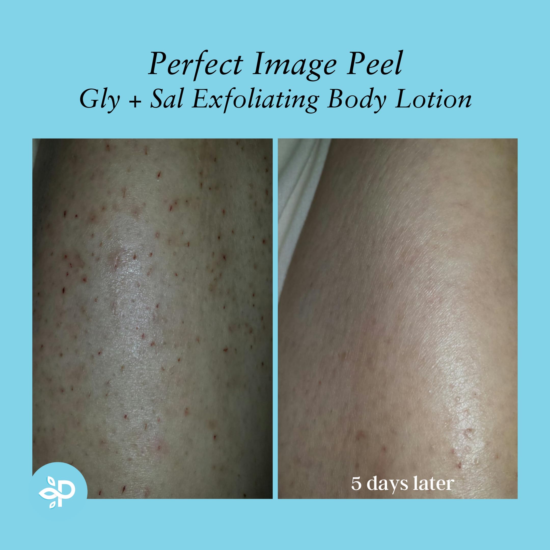 Routine de soin Gly-Sal: usage quotidien pour peau plus saine
