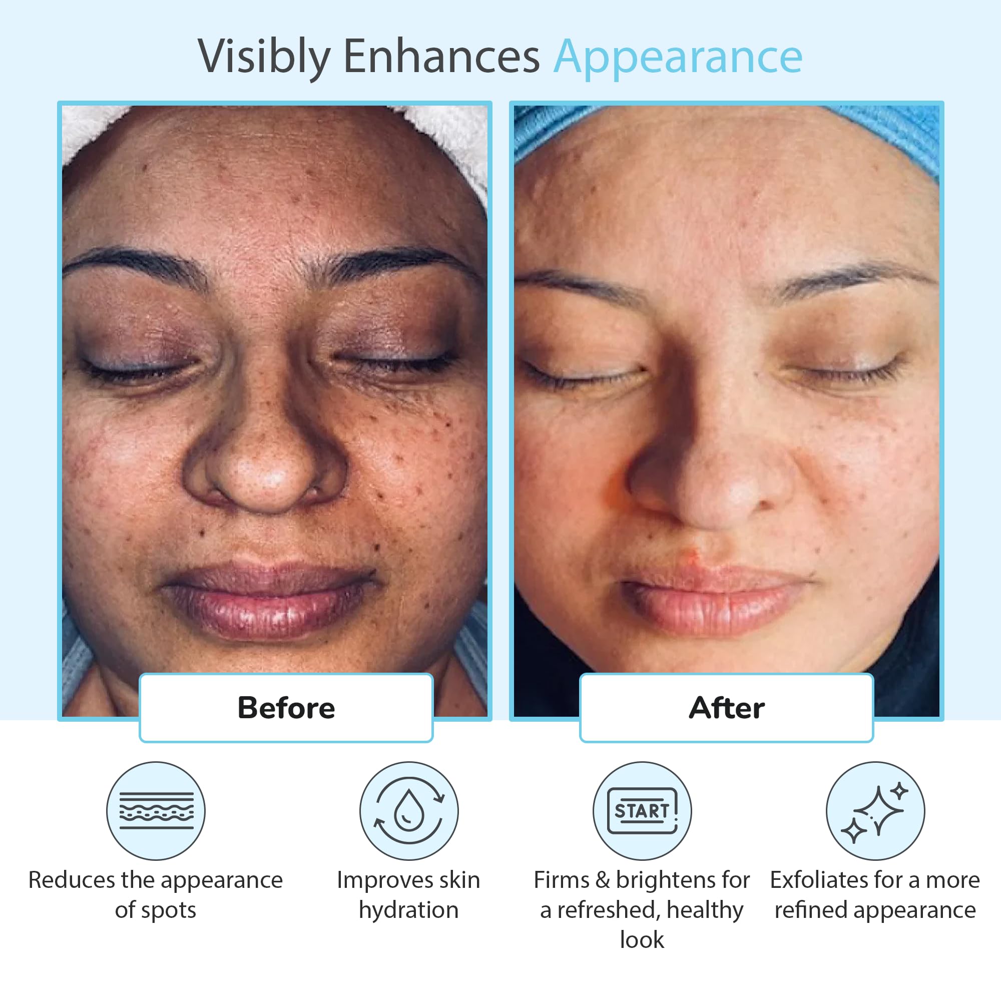 Perfect Image Glycolic 50% Gel Peel con retinol, impulso de renovación