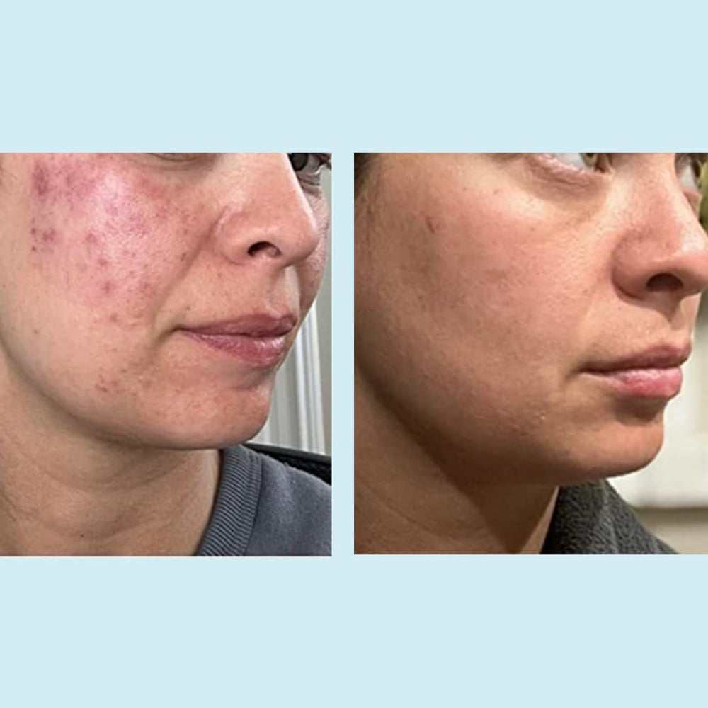 Perfect Image Glycolic 50% Gel Peel ritual nocturno de cuidado
