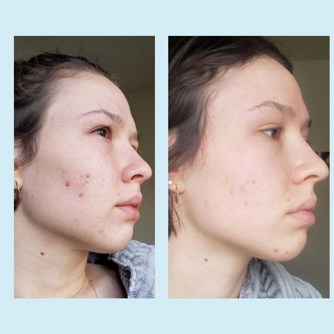 Perfect Image Glycolic 50% Gel Peel spa domestico