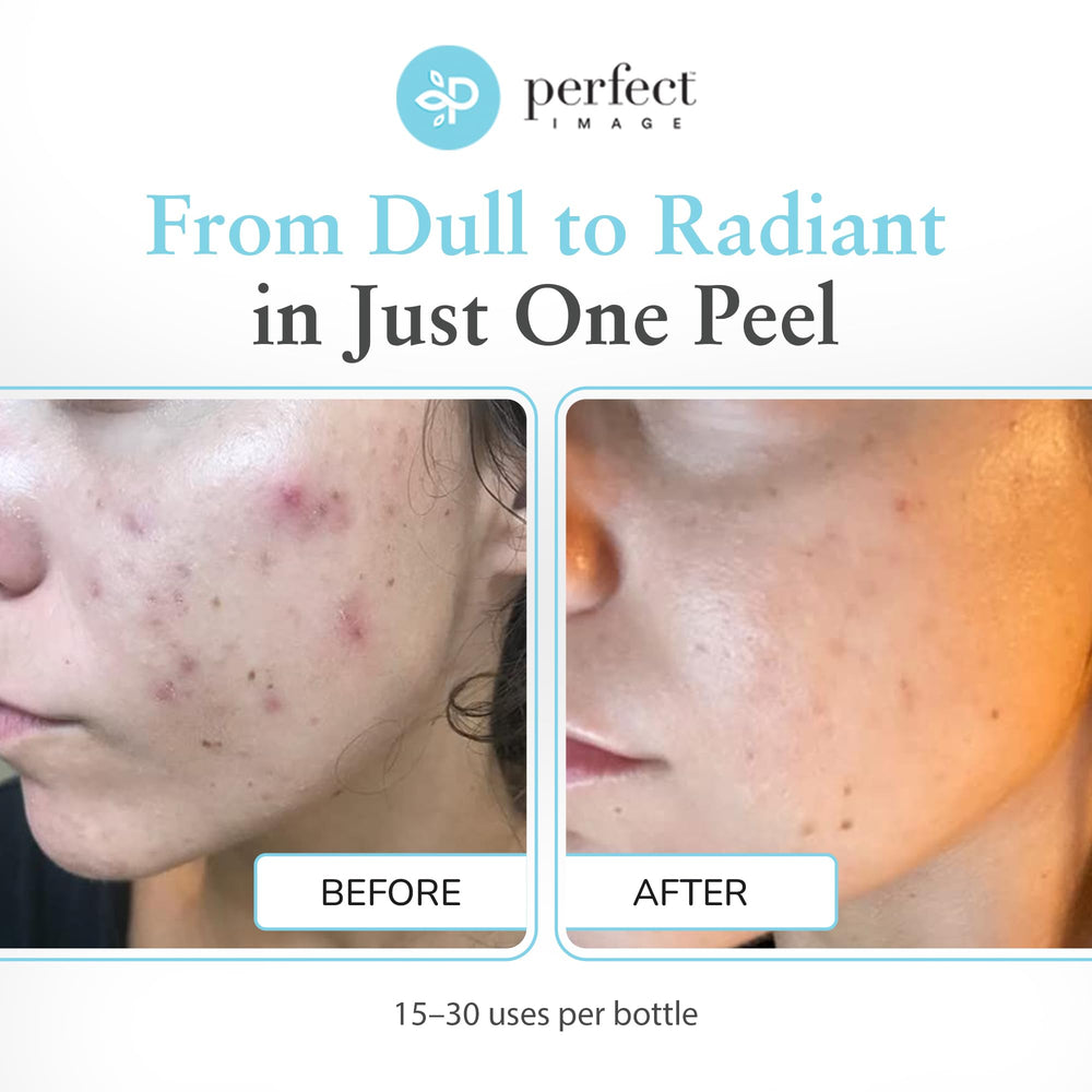 Perfect Image gommage glycolique 30% – extrait thé vert apaise et hydrate