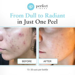 Perfect Image gommage glycolique 30% – extrait thé vert apaise et hydrate