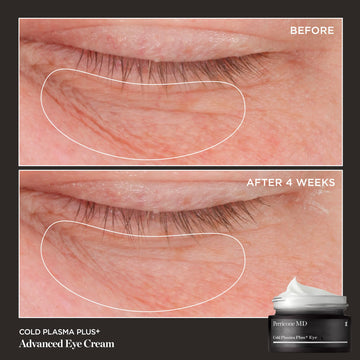Perricone MD Plasma Frío Plus, ilumina el contorno de ojos para un aspecto más vivo.