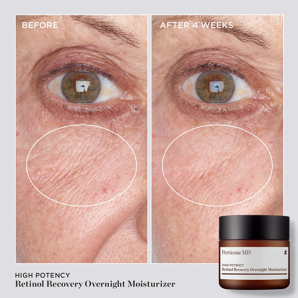 Triple retinol de Perricone MD, favorece renovación de la piel