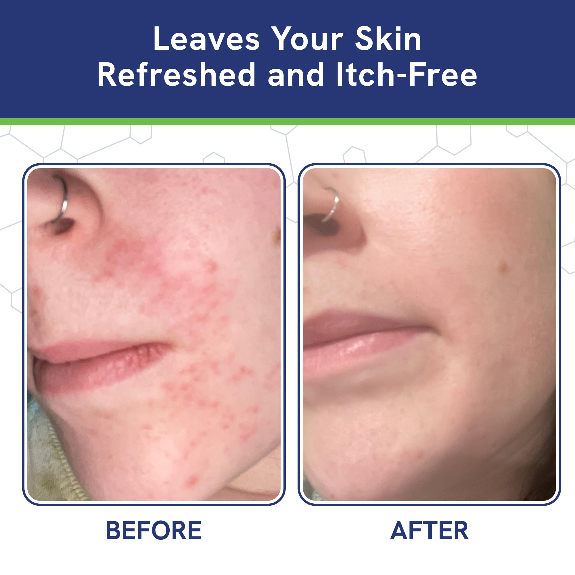 Cuidado de la piel facial y corporal con pHat 5.5