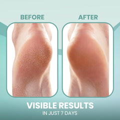 Forro de gel en calcetines PhysFlex para confort suave.