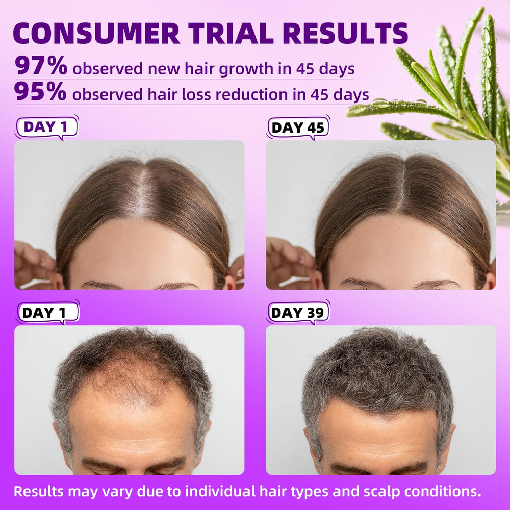 Pipuxi Minoxidil spray dosificador para aplicación precisa