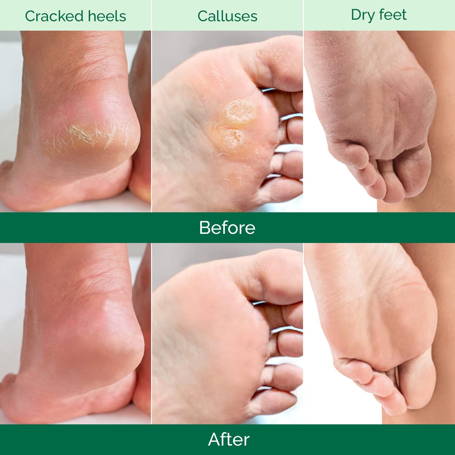PLANTIFIQUE mascarilla exfoliante para pies con aloe vera, hidratación suave.