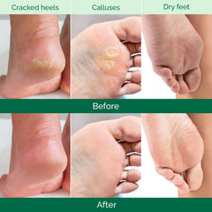 PLANTIFIQUE mascarilla exfoliante para pies con aloe vera, hidratación suave.