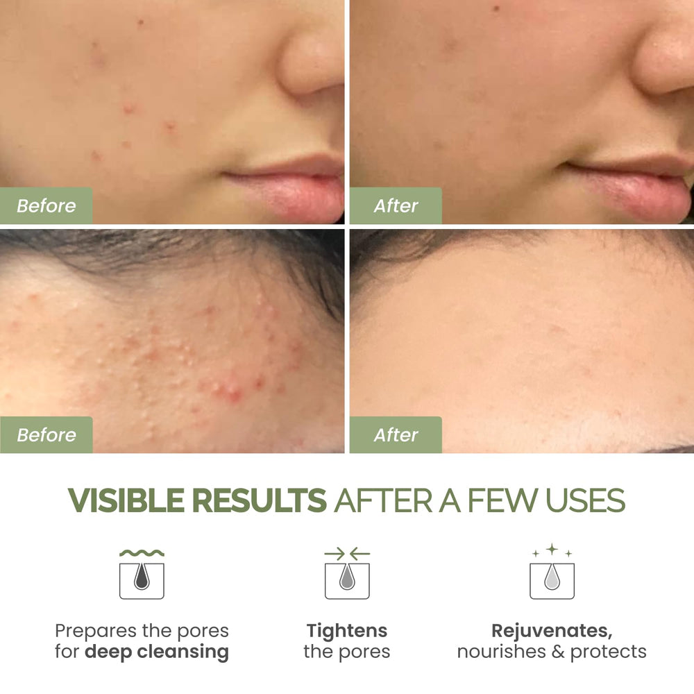 PLANTIFIQUE mascarilla arcilla coreana con espinaca, aporta claridad y frescura