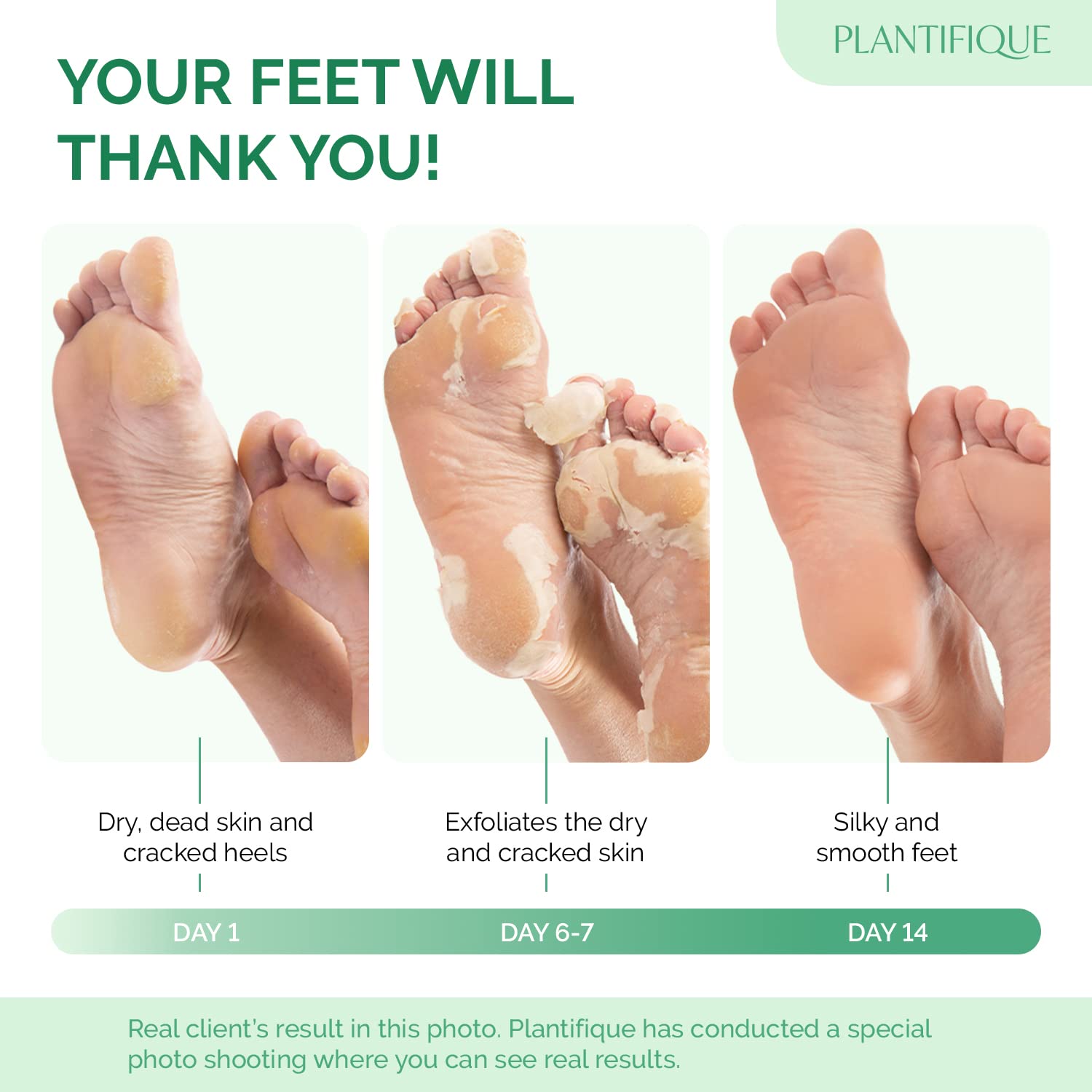 PLANTIFIQUE pack deux masques pieds – solution pratique et économique