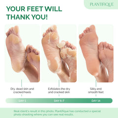 PLANTIFIQUE pack deux masques pieds – solution pratique et économique