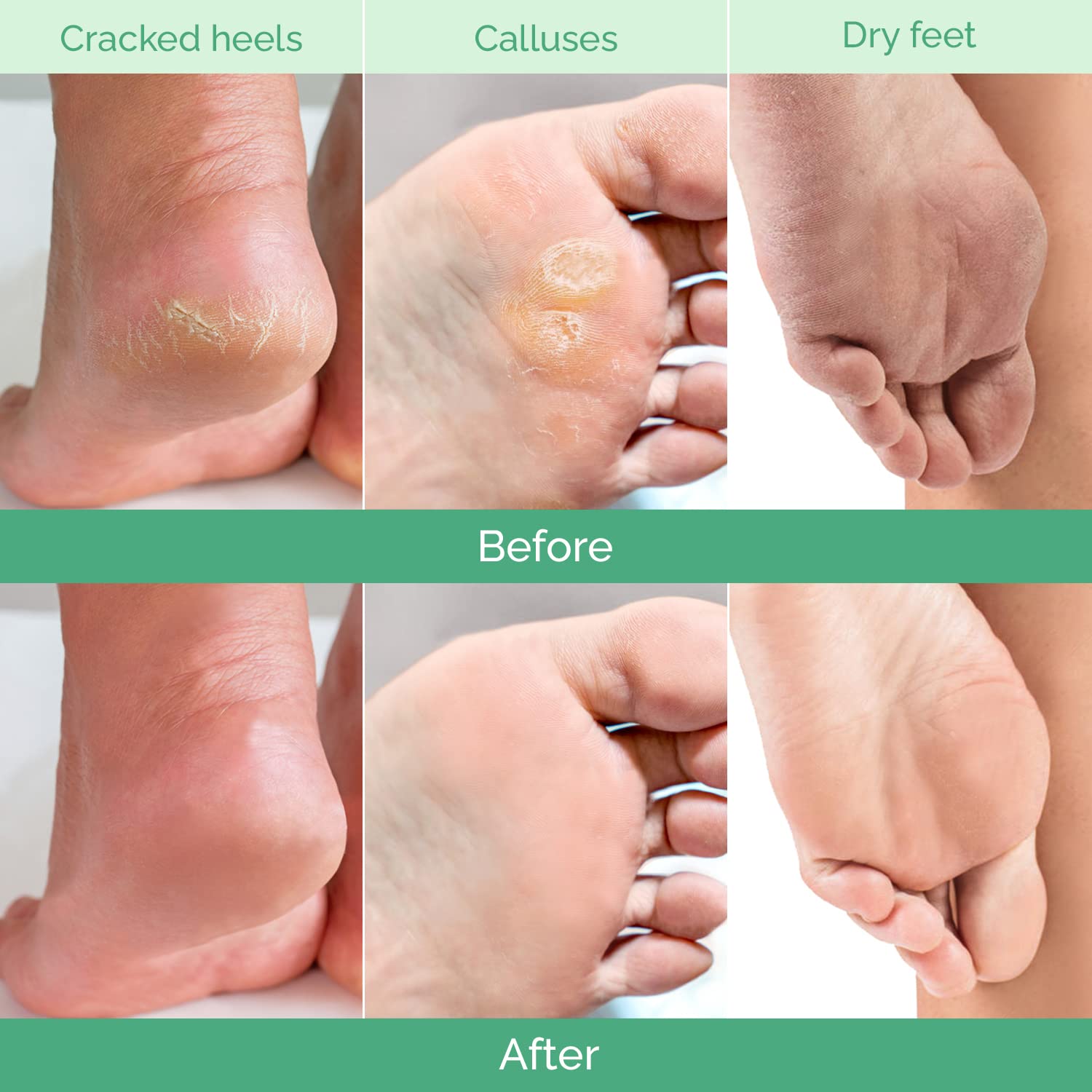 PLANTIFIQUE pies hidratados tras la exfoliación