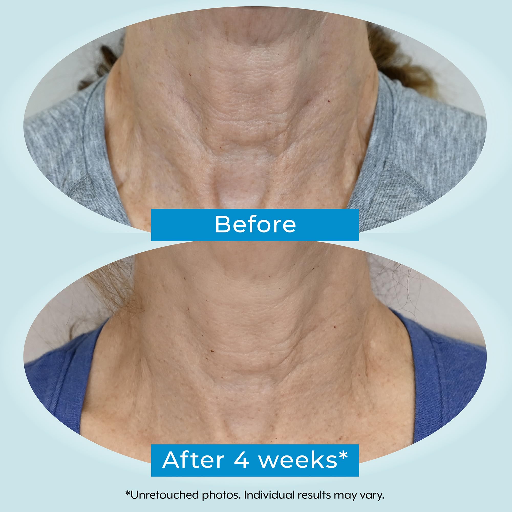 Plexaderm Dual Action Repair: contiene 2% Bakuchiol para textura uniforme.