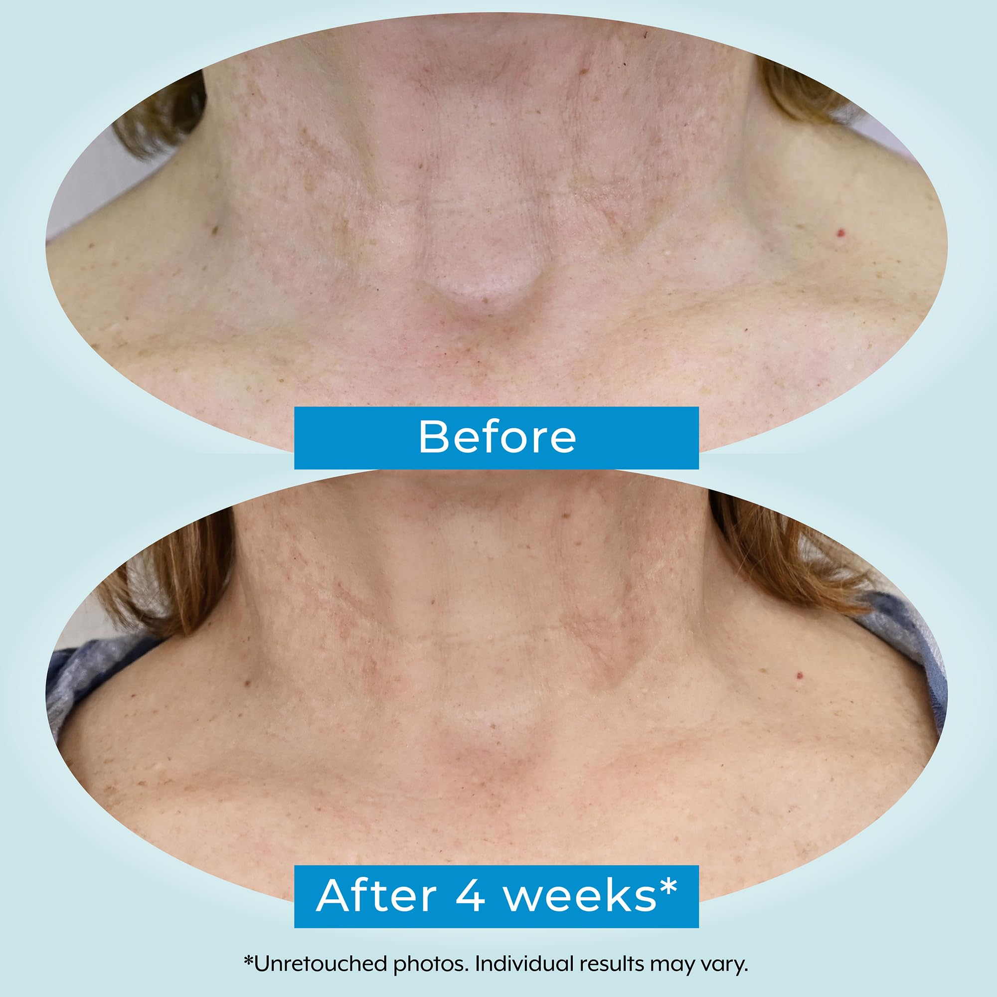 Plexaderm Dual Action Repair: bakuchiol suave, opción amable para piel sensible.