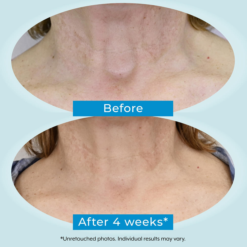 Plexaderm Dual Action Repair: bakuchiol suave, opción amable para piel sensible.