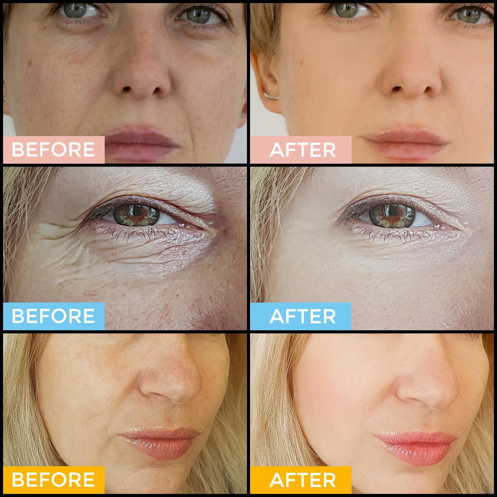 +1HEROLABS serum ácido hialurónico: hidratación profunda y duradera.