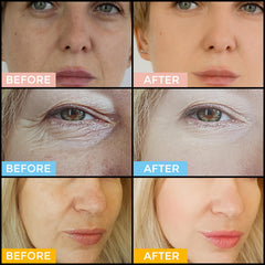 +1HEROLABS serum ácido hialurónico: hidratación profunda y duradera.