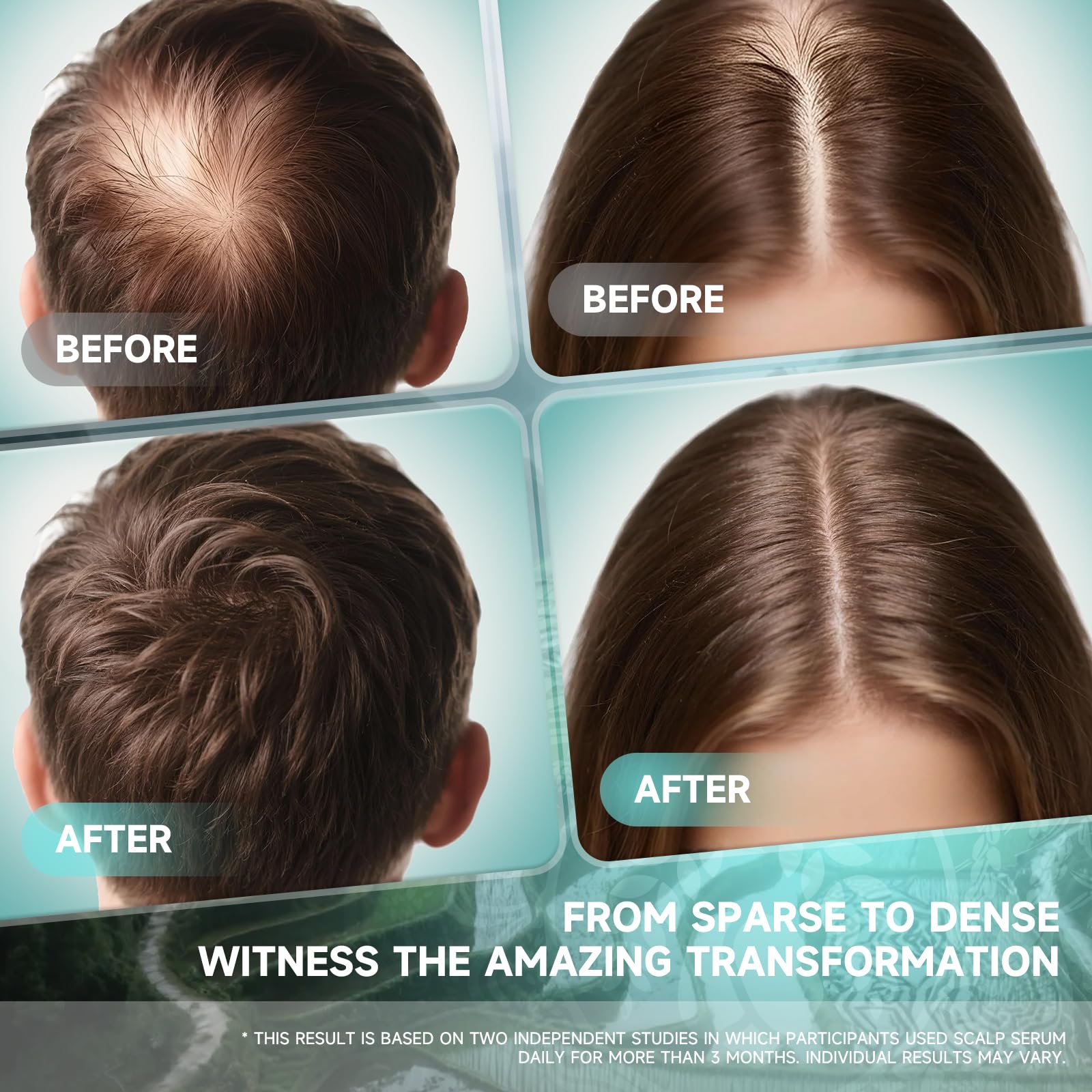 PRFTMK serum aplicador spray directo a raíces.