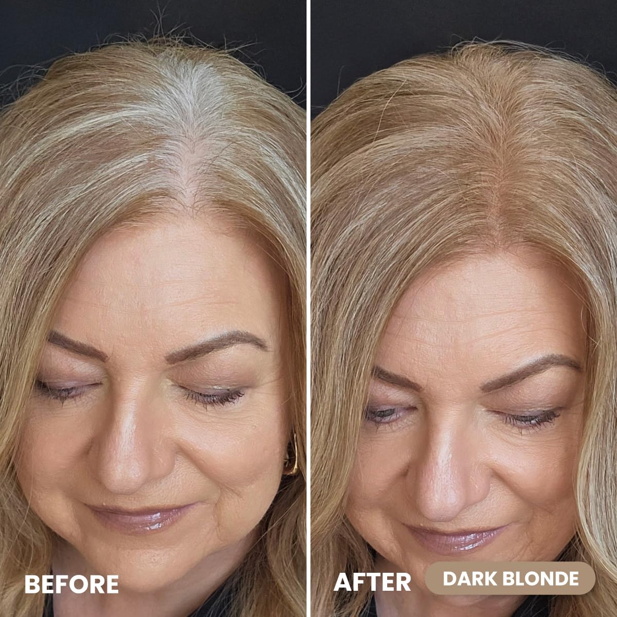 Prime Prometics cubre raíces crecidas de forma suave y natural.