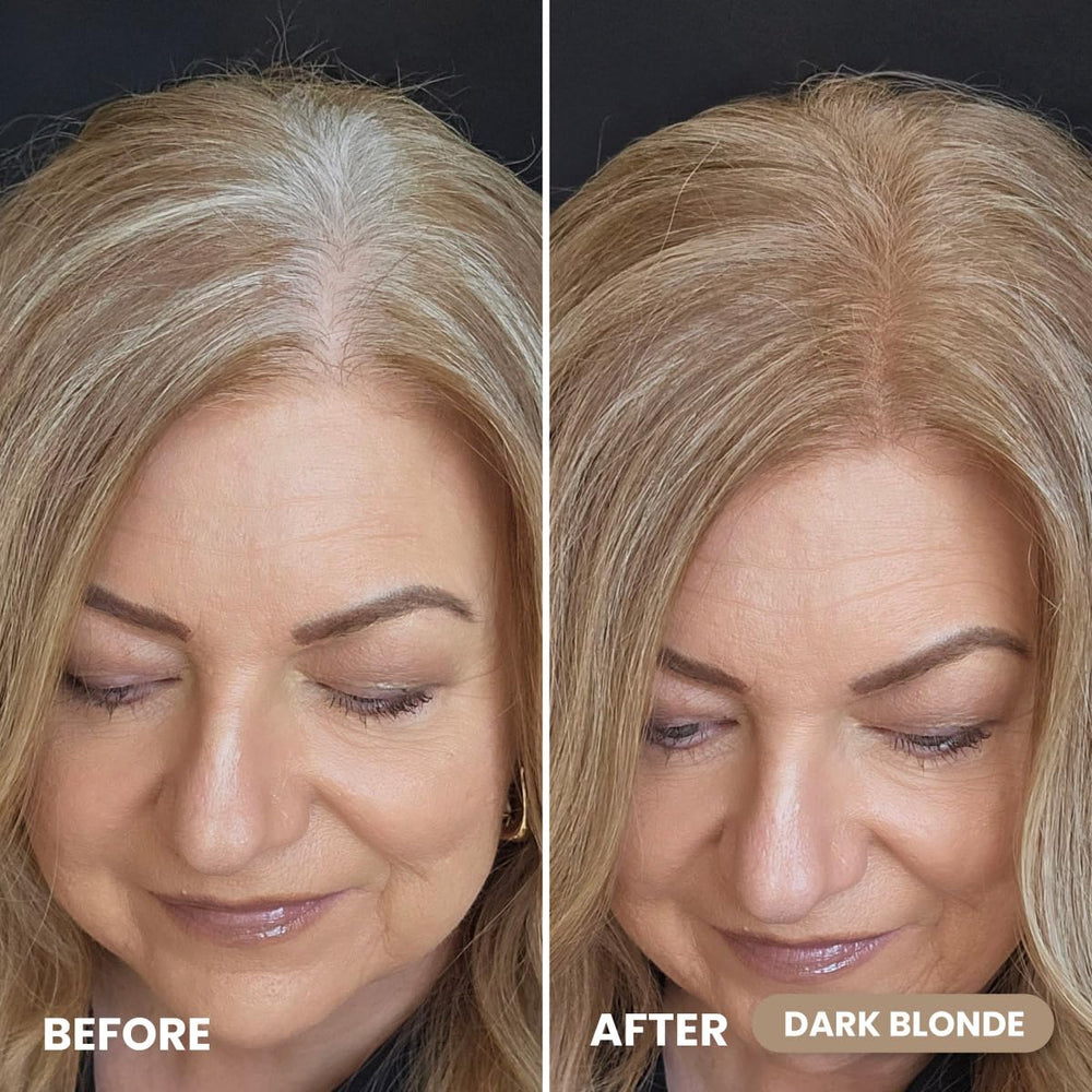 Prime Prometics cubre raíces crecidas de forma suave y natural.