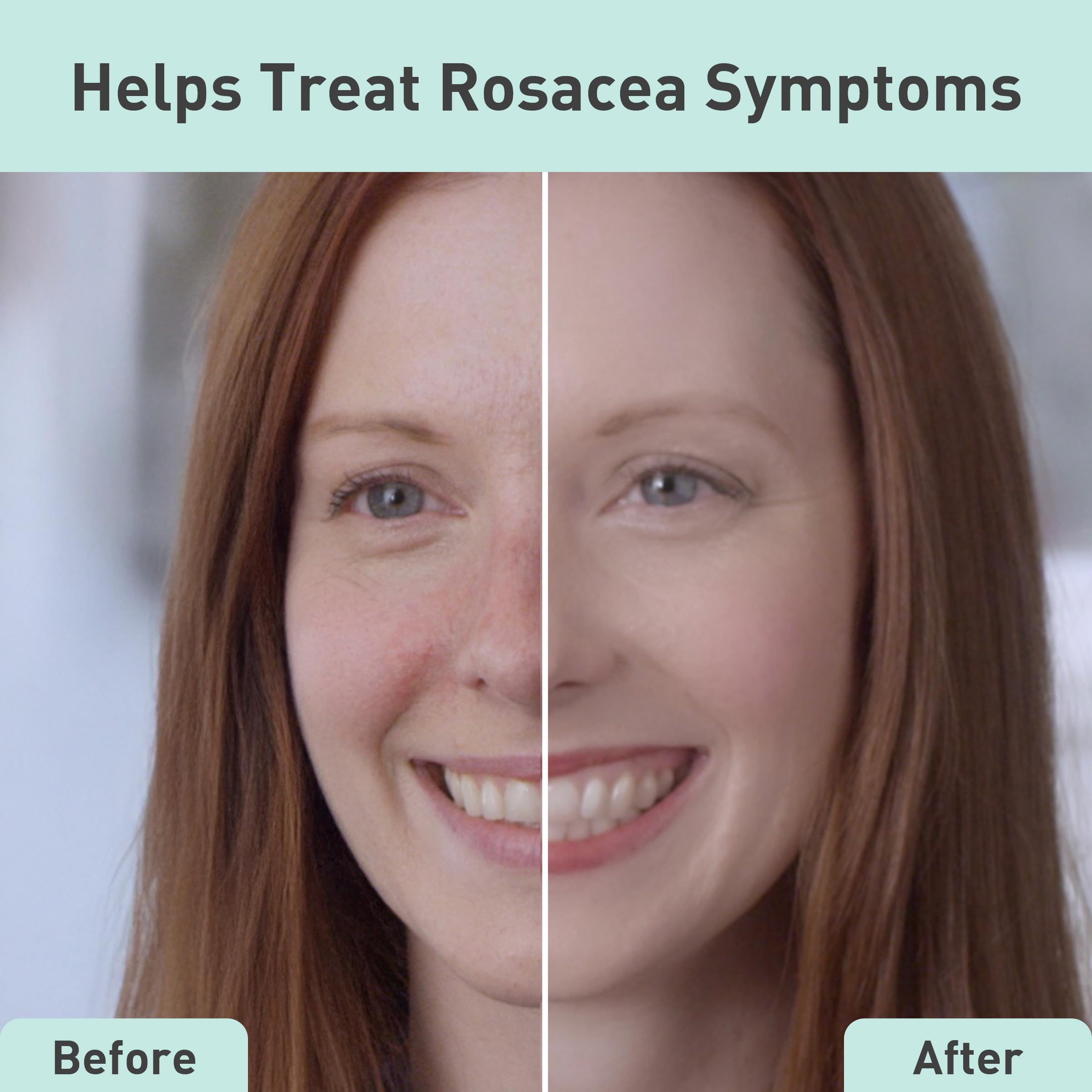 PROcure Rosacare CC Hidrogel con extracto de regaliz para equilibrio