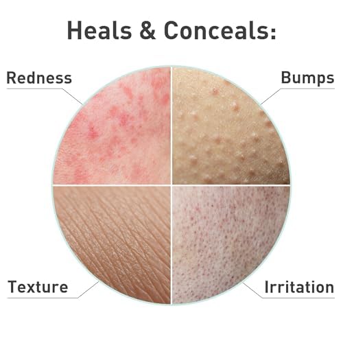 PROcure Rosacare CC Hidrogel reduce enrojecimiento facial