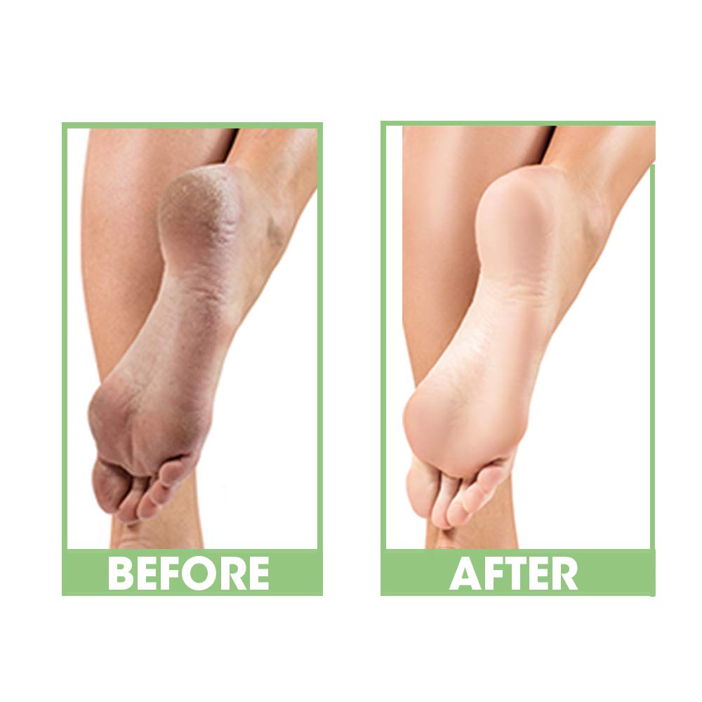 ProLinc Dry Heel Eliminator de absorción rápida para pies suaves
