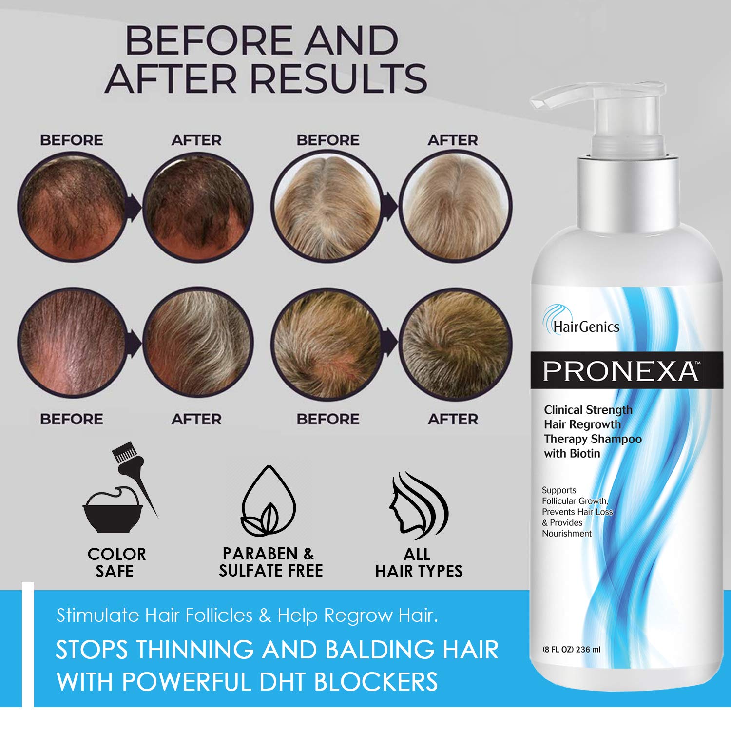 Pronexa: imagen de aplicación diaria en cabello para mejor manejo